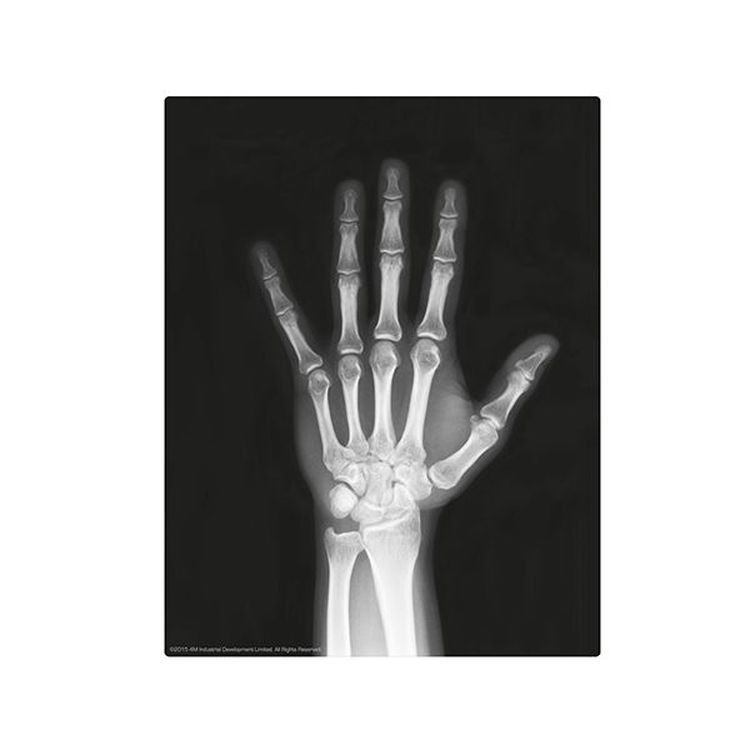 Набор юного врача «Скелет человека» — картинка 5